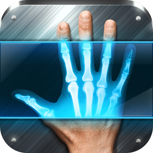 X-rays on cell phone: discover the application that simulates X-ray images